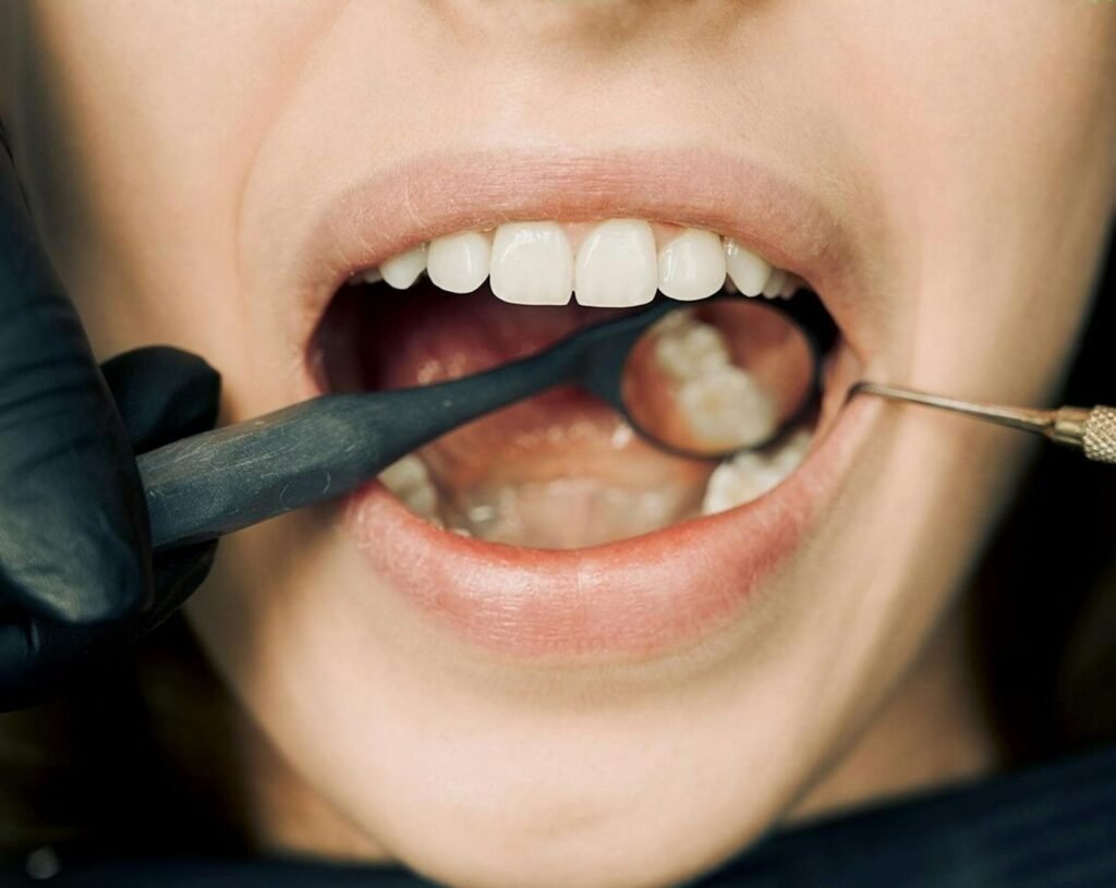 Sonhar com dente quebrado